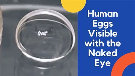 can you see a human egg with the naked eye